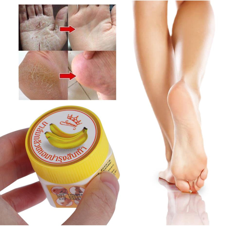 Banana cream for foot and heel care